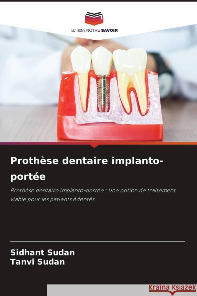 Prothèse dentaire implanto-portée Sudan, Sidhant, Sudan, Tanvi 9786205084618