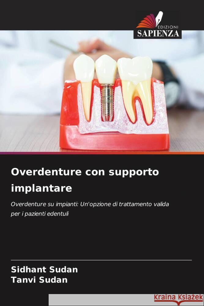 Overdenture con supporto implantare Sudan, Sidhant, Sudan, Tanvi 9786205084625