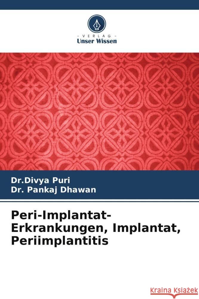 Peri-Implantat-Erkrankungen, Implantat, Periimplantitis Puri, Divya, Dhawan, Pankaj 9786205084779