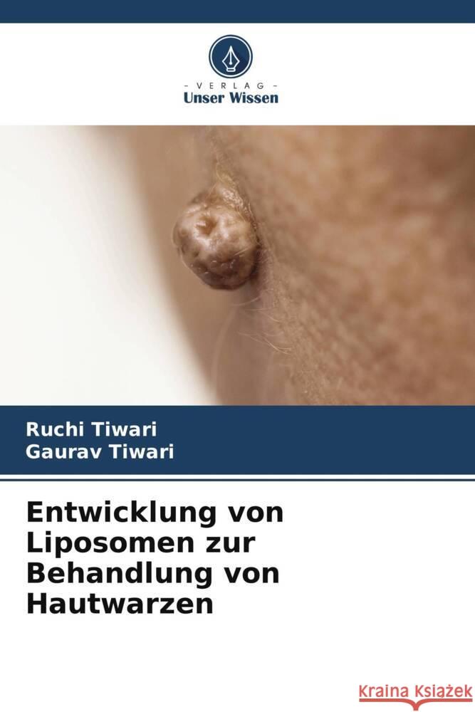 Entwicklung von Liposomen zur Behandlung von Hautwarzen Tiwari, Ruchi, Tiwari, Gaurav 9786205085073