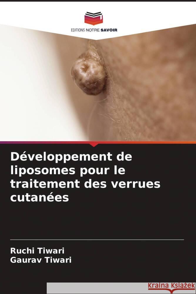 Développement de liposomes pour le traitement des verrues cutanées Tiwari, Ruchi, Tiwari, Gaurav 9786205085097 Editions Notre Savoir