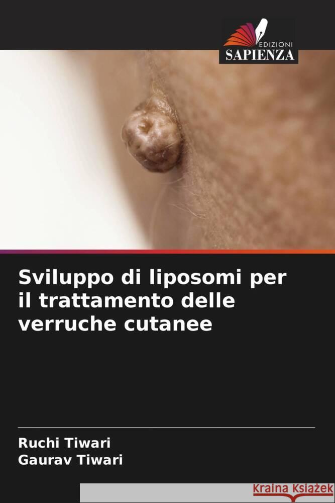 Sviluppo di liposomi per il trattamento delle verruche cutanee Tiwari, Ruchi, Tiwari, Gaurav 9786205085103