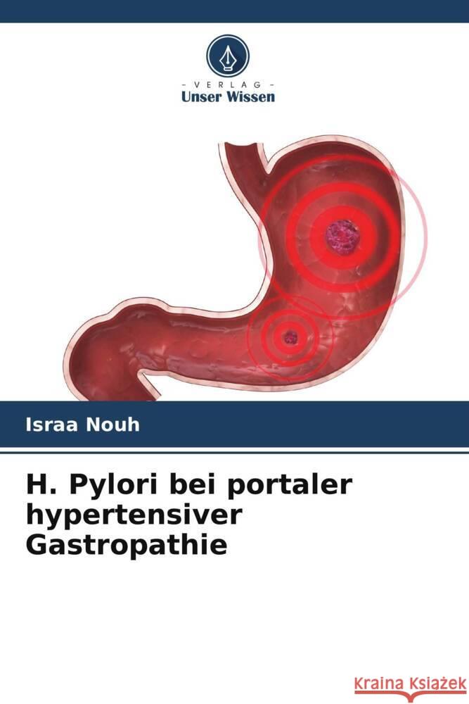 H. Pylori bei portaler hypertensiver Gastropathie Nouh, Israa 9786205105399 Verlag Unser Wissen