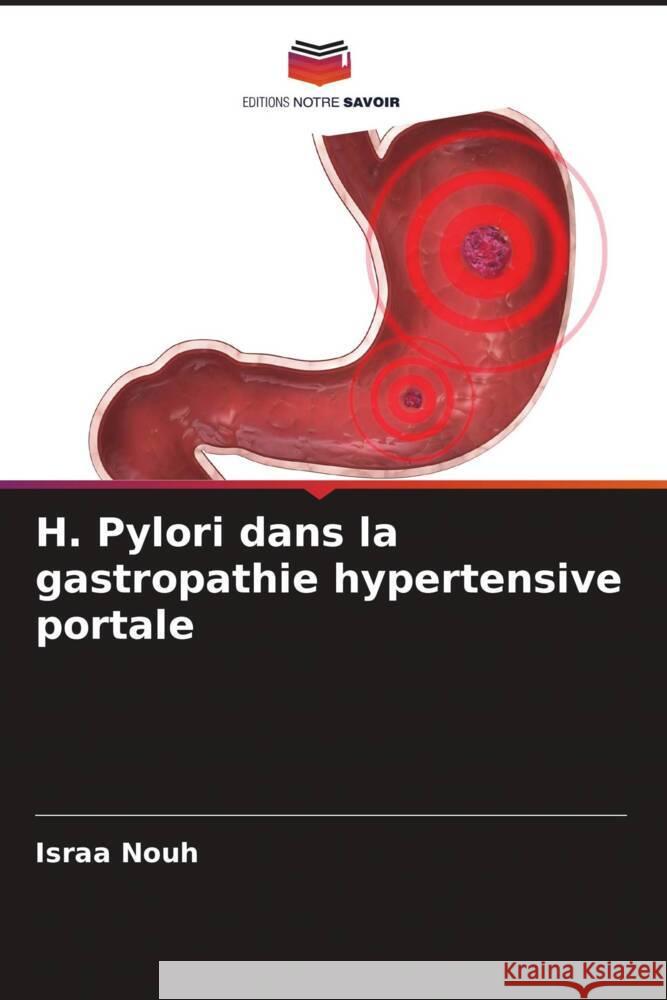 H. Pylori dans la gastropathie hypertensive portale Nouh, Israa 9786205105443 Editions Notre Savoir