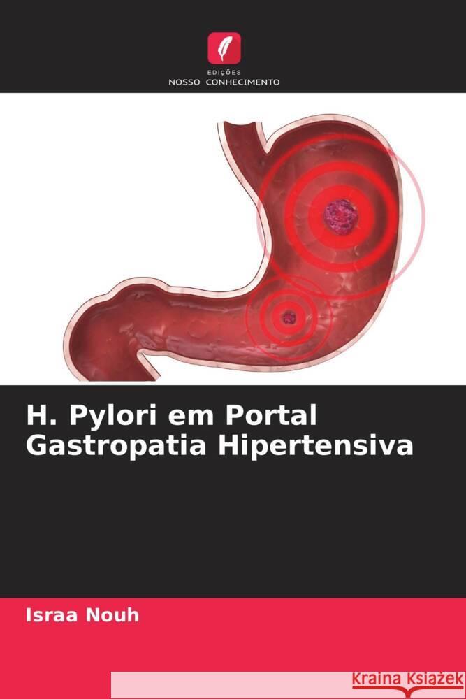 H. Pylori em Portal Gastropatia Hipertensiva Nouh, Israa 9786205105467 Edições Nosso Conhecimento