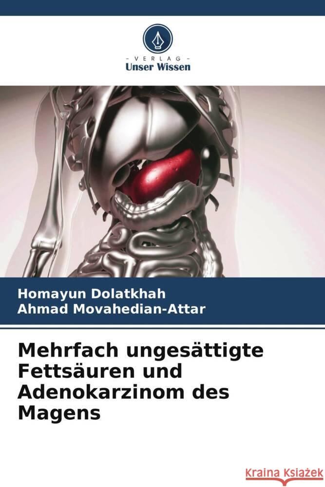 Mehrfach ungesättigte Fettsäuren und Adenokarzinom des Magens Dolatkhah, Homayun, Movahedian-Attar, Ahmad 9786205107003