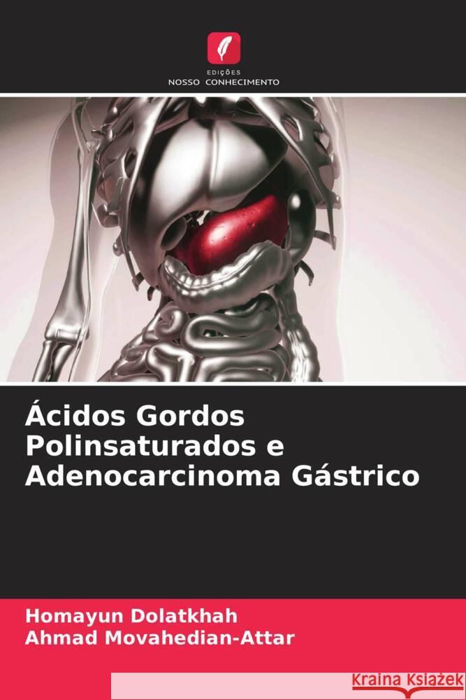 Ácidos Gordos Polinsaturados e Adenocarcinoma Gástrico Dolatkhah, Homayun, Movahedian-Attar, Ahmad 9786205107058 Edições Nosso Conhecimento