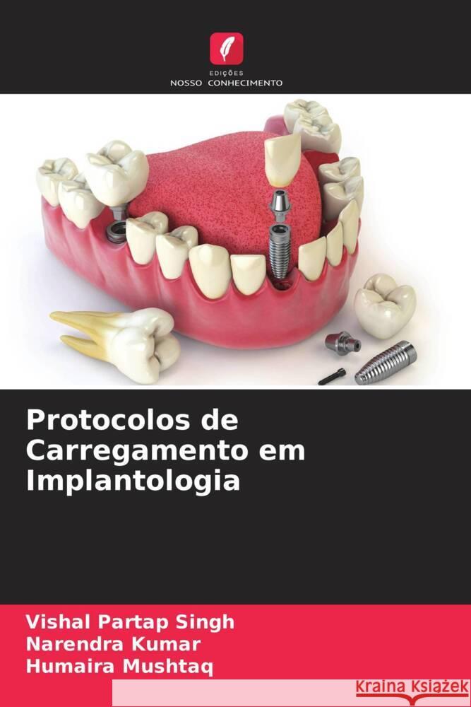 Protocolos de Carregamento em Implantologia Singh, Vishal Partap, Kumar, Narendra, Mushtaq, Humaira 9786205109472 Edições Nosso Conhecimento