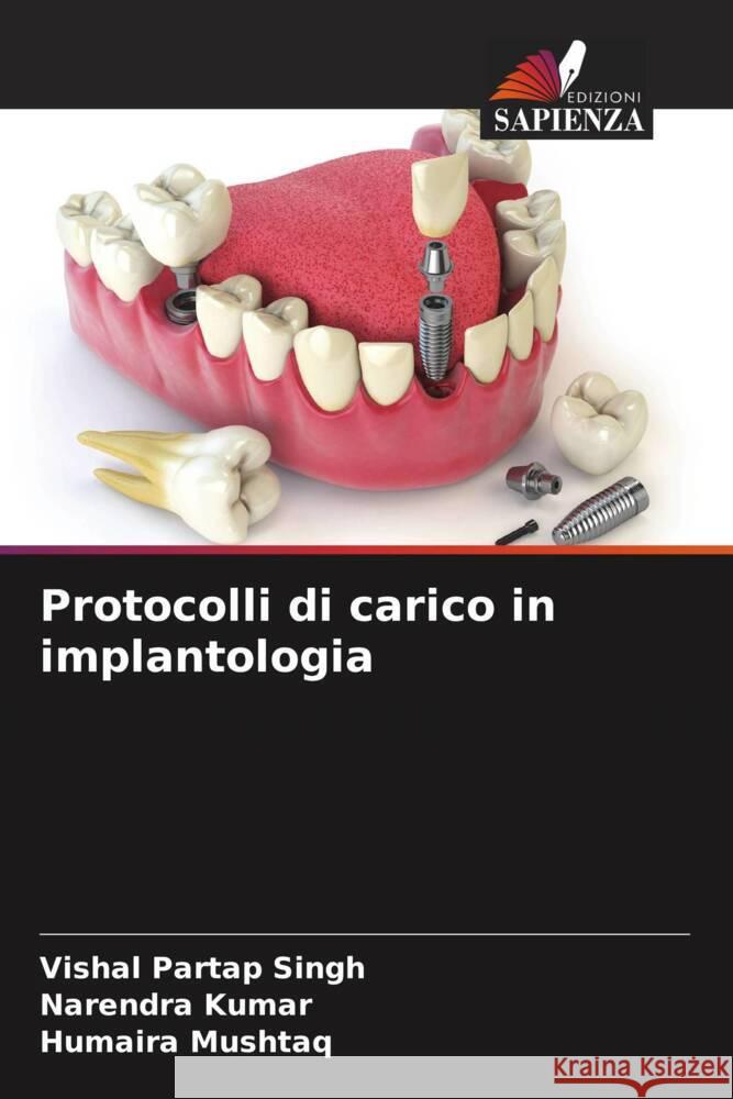 Protocolli di carico in implantologia Singh, Vishal Partap, Kumar, Narendra, Mushtaq, Humaira 9786205109489