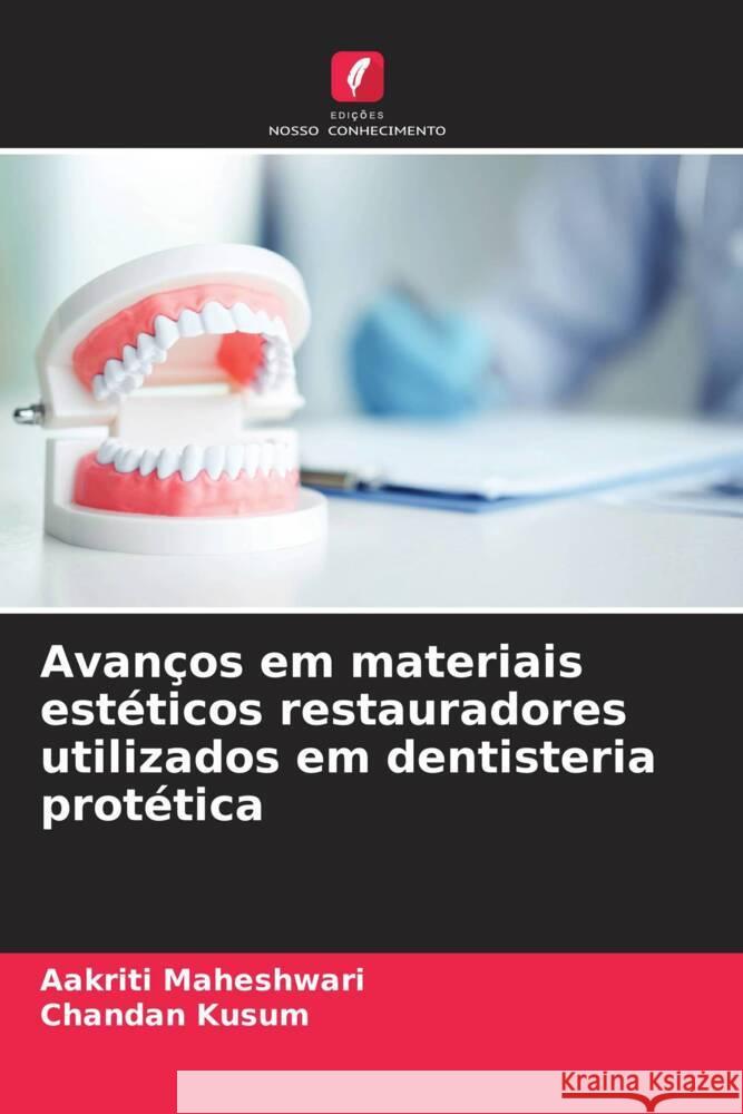 Avanços em materiais estéticos restauradores utilizados em dentisteria protética Maheshwari, Aakriti, Kusum, chandan 9786205112588 Edições Nosso Conhecimento