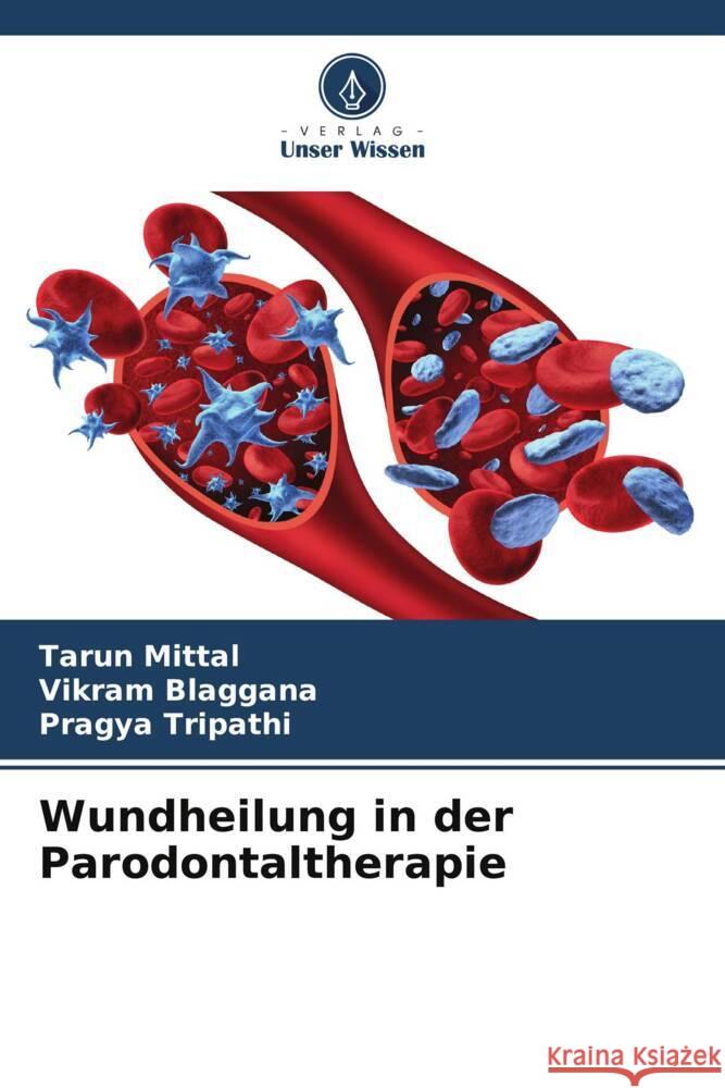 Wundheilung in der Parodontaltherapie Mittal, Tarun, Blaggana, Vikram, Tripathi, Pragya 9786205112663 Verlag Unser Wissen