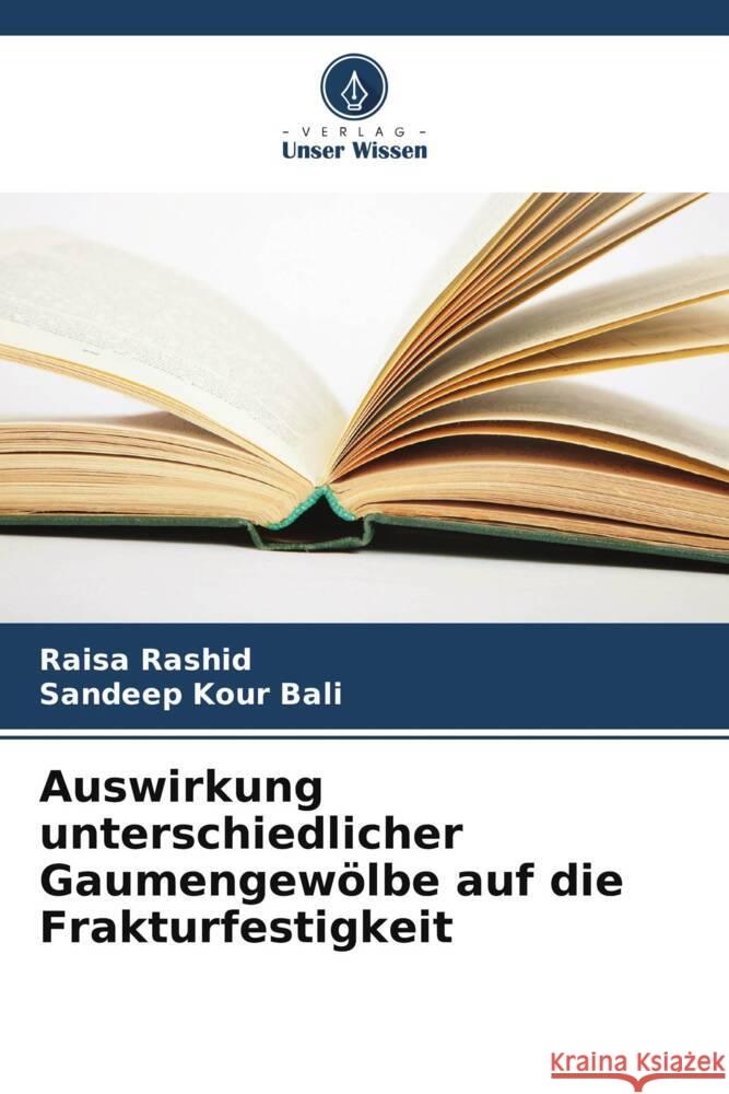 Auswirkung unterschiedlicher Gaumengewölbe auf die Frakturfestigkeit Rashid, Raisa, Kour Bali, Sandeep 9786205117781 Verlag Unser Wissen