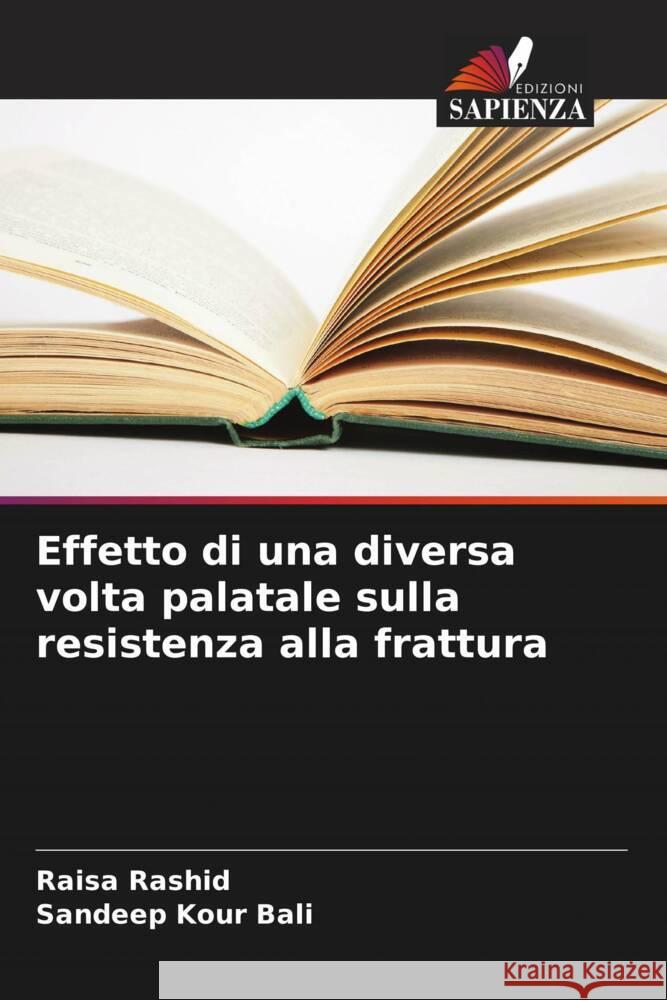 Effetto di una diversa volta palatale sulla resistenza alla frattura Rashid, Raisa, Kour Bali, Sandeep 9786205117811 Edizioni Sapienza