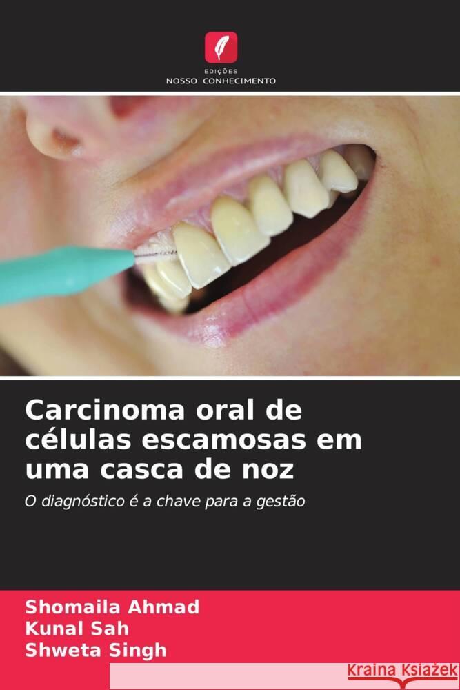 Carcinoma oral de células escamosas em uma casca de noz Ahmad, Shomaila, Sah, Kunal, Singh, Shweta 9786205122280