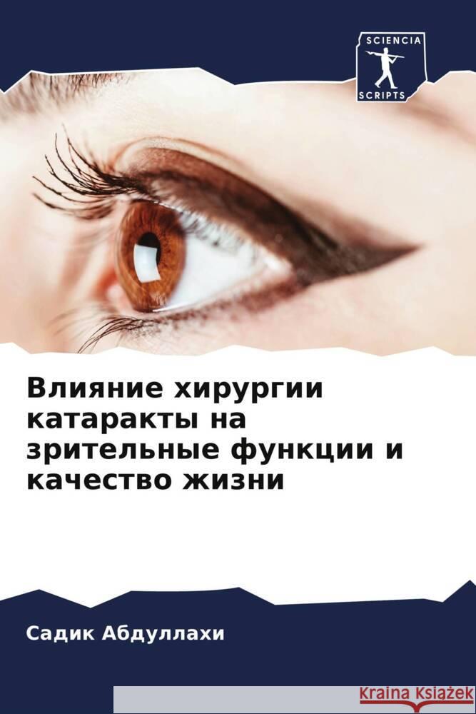 Vliqnie hirurgii katarakty na zritel'nye funkcii i kachestwo zhizni Abdullahi, Sadik 9786205125090 Sciencia Scripts