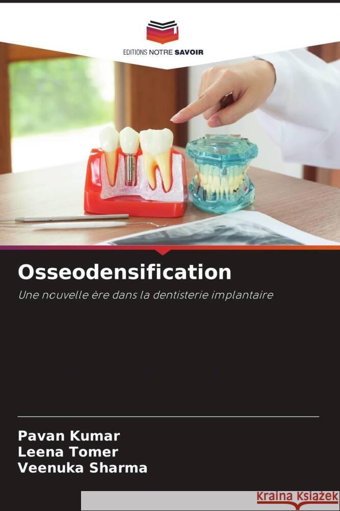 Osseodensification Kumar, Pavan, Tomer, Leena, Sharma, Veenuka 9786205127223 Editions Notre Savoir