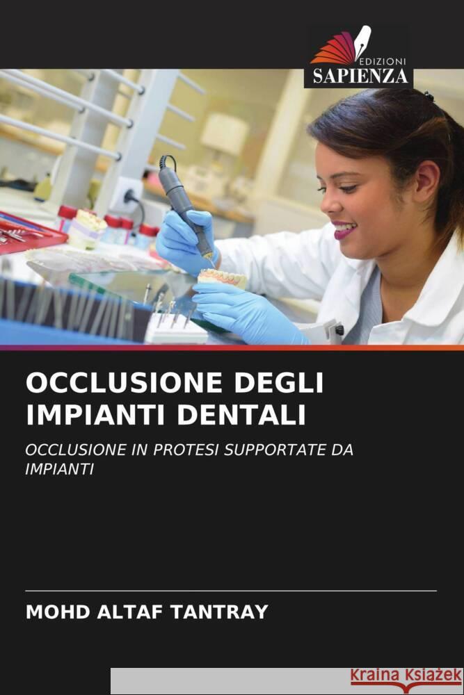 OCCLUSIONE DEGLI IMPIANTI DENTALI Tantray, Mohd Altaf 9786205127674 Edizioni Sapienza