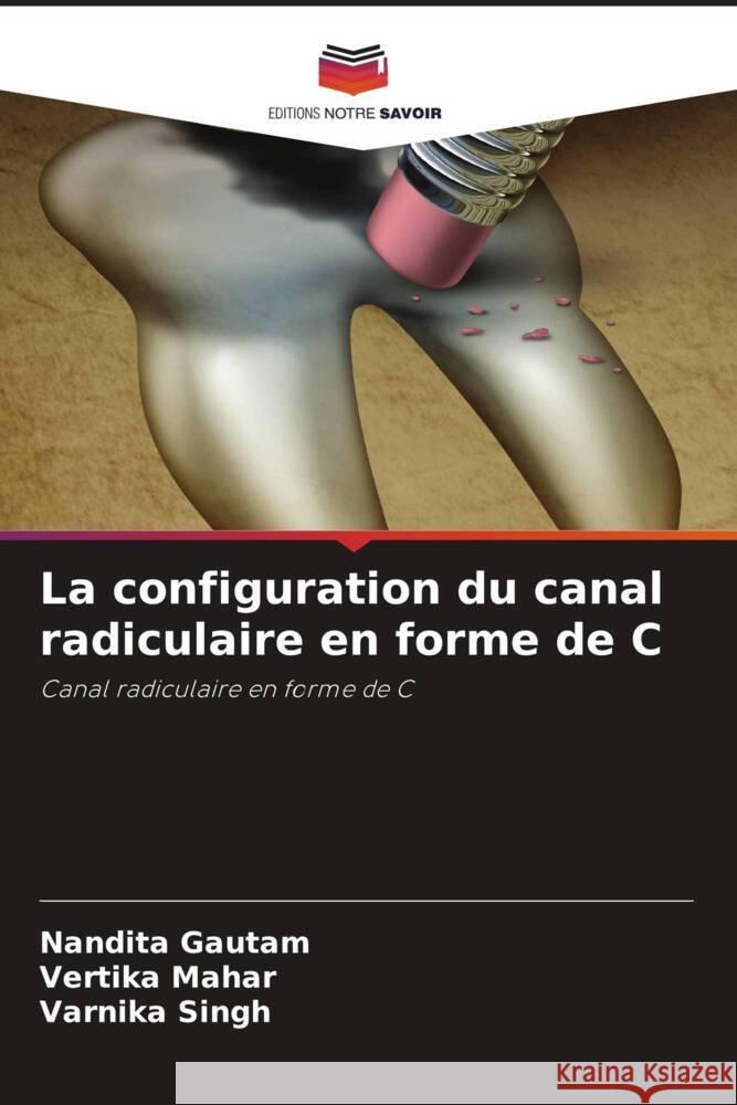 La configuration du canal radiculaire en forme de C Gautam, Nandita, Mahar, Vertika, Singh, Varnika 9786205129142