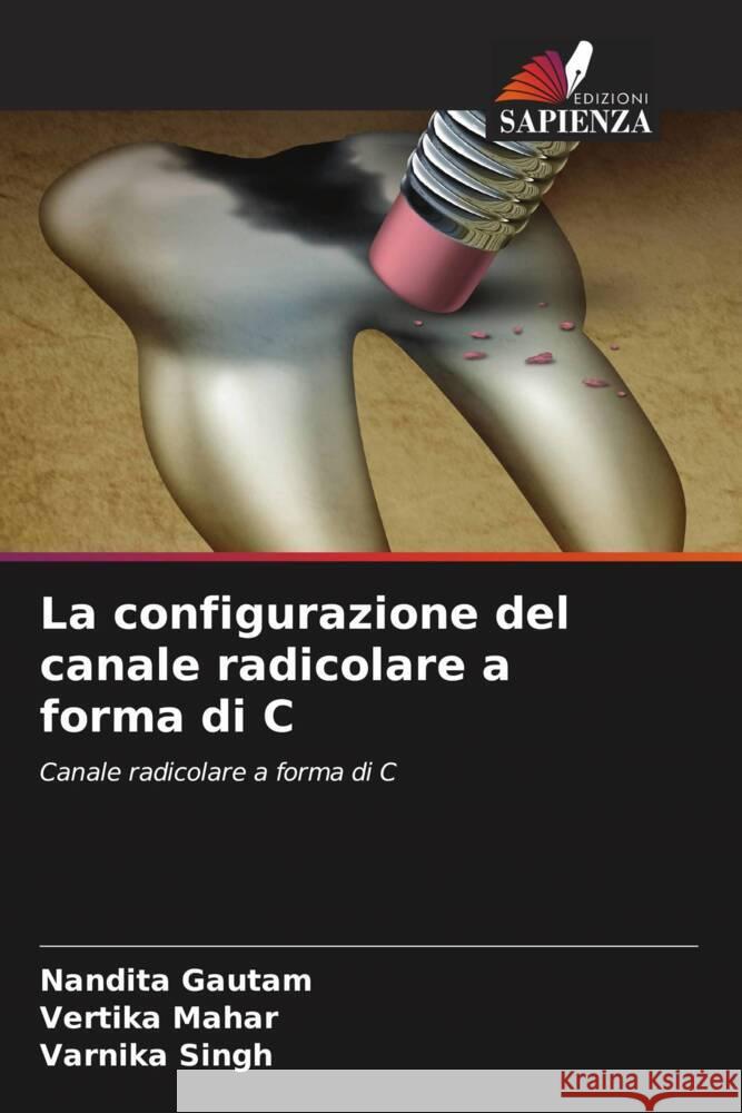 La configurazione del canale radicolare a forma di C Gautam, Nandita, Mahar, Vertika, Singh, Varnika 9786205129159