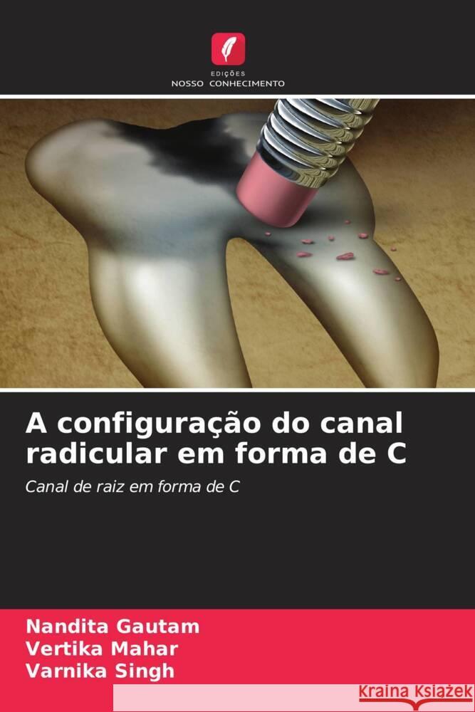 A configuração do canal radicular em forma de C Gautam, Nandita, Mahar, Vertika, Singh, Varnika 9786205129166 Edições Nosso Conhecimento