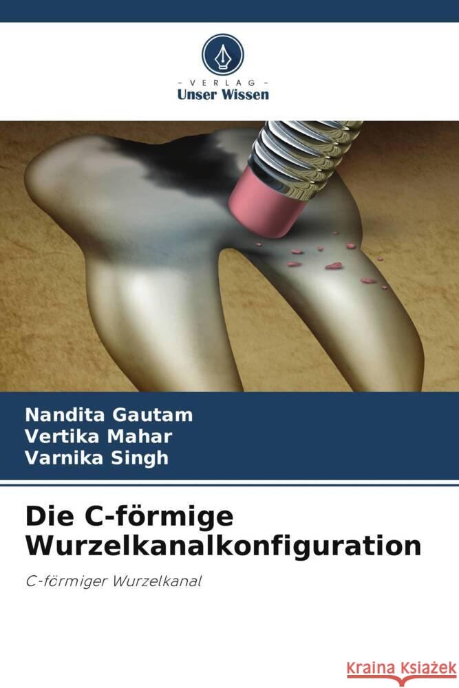 Die C-förmige Wurzelkanalkonfiguration Gautam, Nandita, Mahar, Vertika, Singh, Varnika 9786205129364