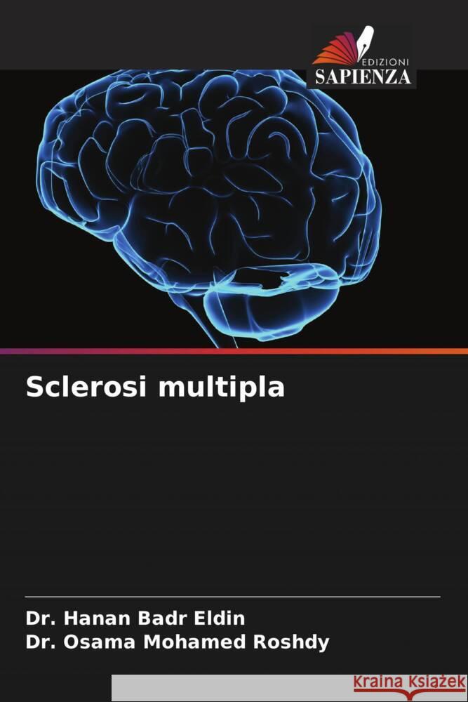 Sclerosi multipla Badr Eldin, Dr. Hanan, Mohamed Roshdy, Dr. Osama 9786205129470 Edizioni Sapienza