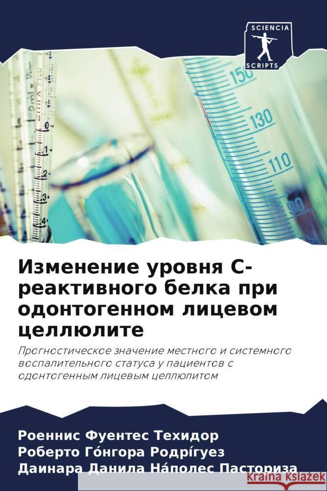 Izmenenie urownq S-reaktiwnogo belka pri odontogennom licewom cellülite Fuentes Tehidor, Roennis, Góngora Rodríguez, Roberto, Nápoles Pastoriza, Dainara Danila 9786205131817 Sciencia Scripts