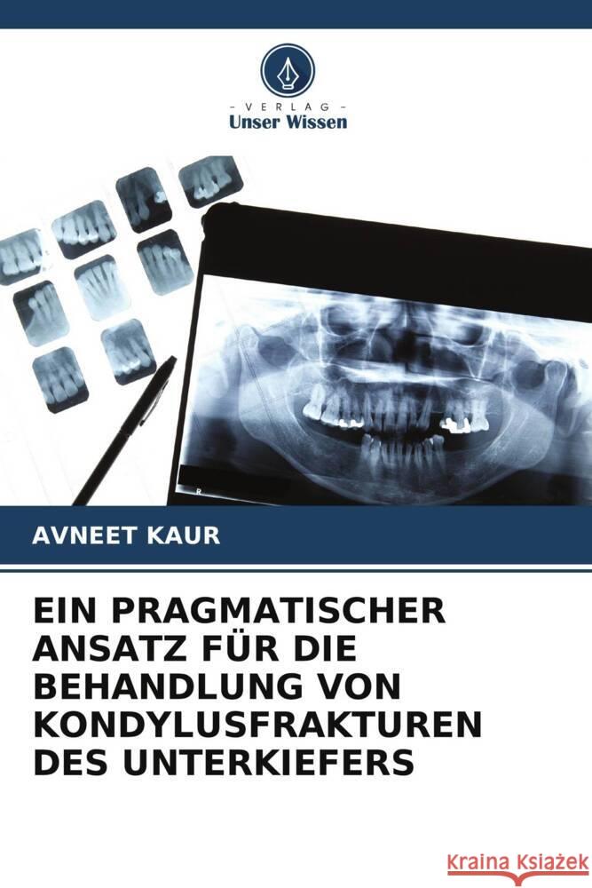 EIN PRAGMATISCHER ANSATZ FÜR DIE BEHANDLUNG VON KONDYLUSFRAKTUREN DES UNTERKIEFERS Kaur, Avneet 9786205138656 Verlag Unser Wissen