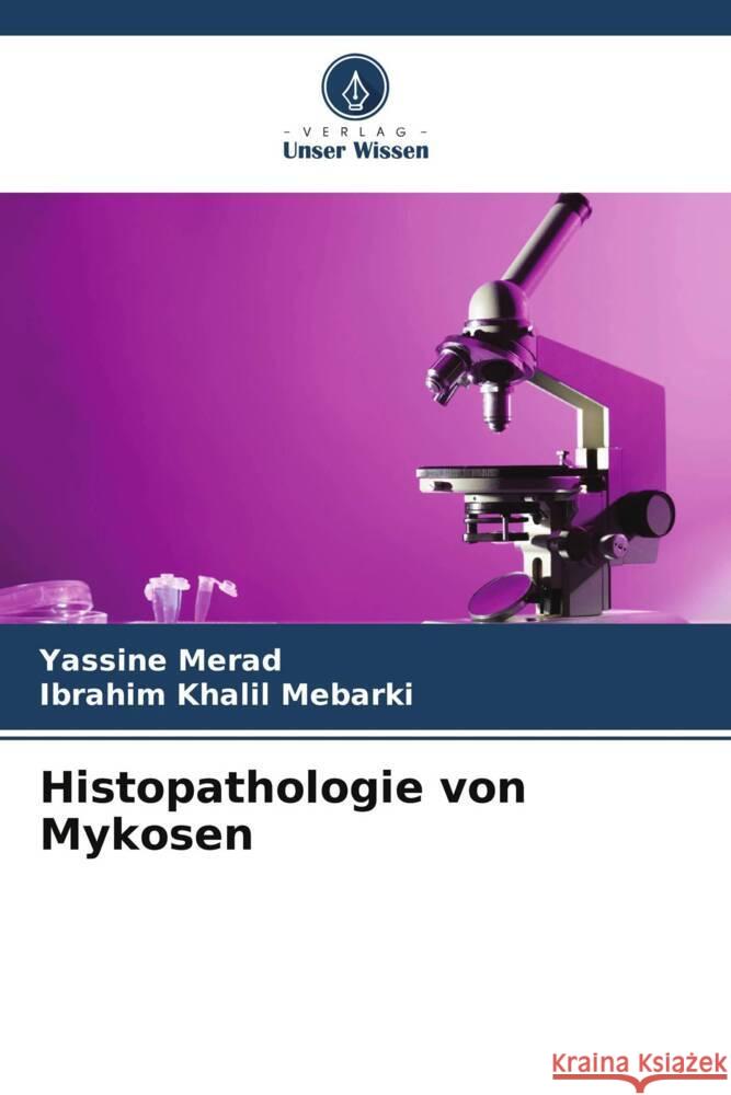 Histopathologie von Mykosen Merad, Yassine, Mebarki, Ibrahim Khalil 9786205142158