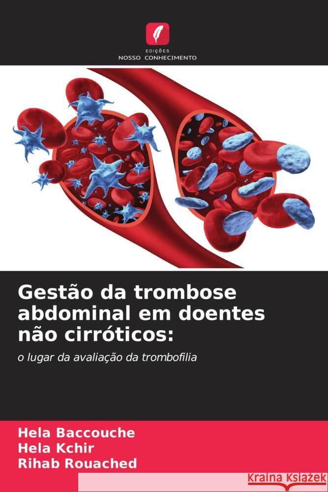 Gestão da trombose abdominal em doentes não cirróticos: Baccouche, Hela, Kchir, Héla, Rouached, Rihab 9786205147207