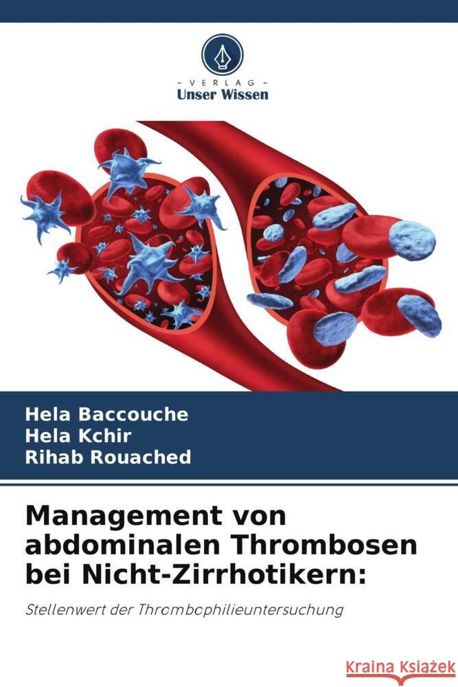 Management von abdominalen Thrombosen bei Nicht-Zirrhotikern: Baccouche, Hela, Kchir, Héla, Rouached, Rihab 9786205147375