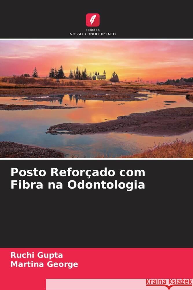 Posto Reforçado com Fibra na Odontologia Gupta, Ruchi, George, Martina 9786205148600 Edições Nosso Conhecimento