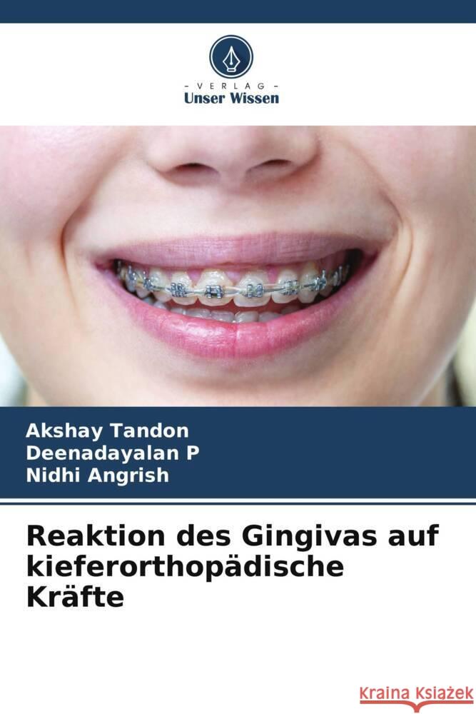 Reaktion des Gingivas auf kieferorthopädische Kräfte Tandon, Akshay, P, Deenadayalan, Angrish, Nidhi 9786205148822