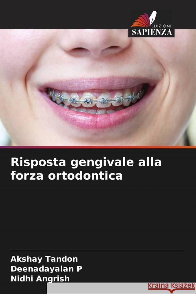 Risposta gengivale alla forza ortodontica Tandon, Akshay, P, Deenadayalan, Angrish, Nidhi 9786205148853 Edizioni Sapienza