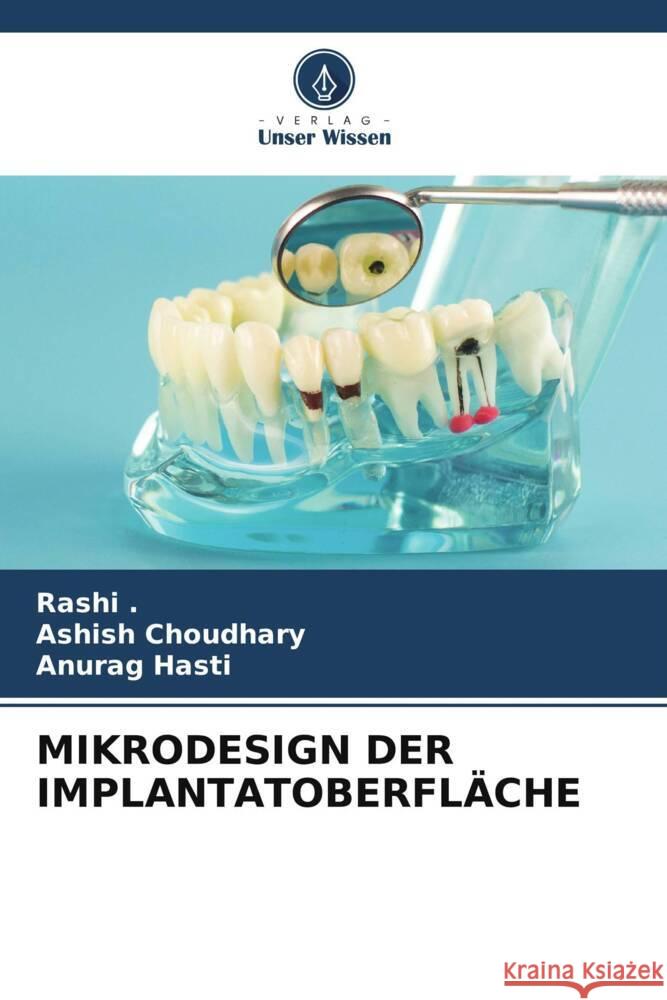 MIKRODESIGN DER IMPLANTATOBERFLÄCHE ., Rashi, Choudhary, Ashish, Hasti, Anurag 9786205151099 Verlag Unser Wissen