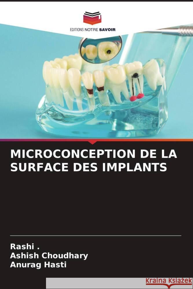 MICROCONCEPTION DE LA SURFACE DES IMPLANTS ., Rashi, Choudhary, Ashish, Hasti, Anurag 9786205151105 Editions Notre Savoir