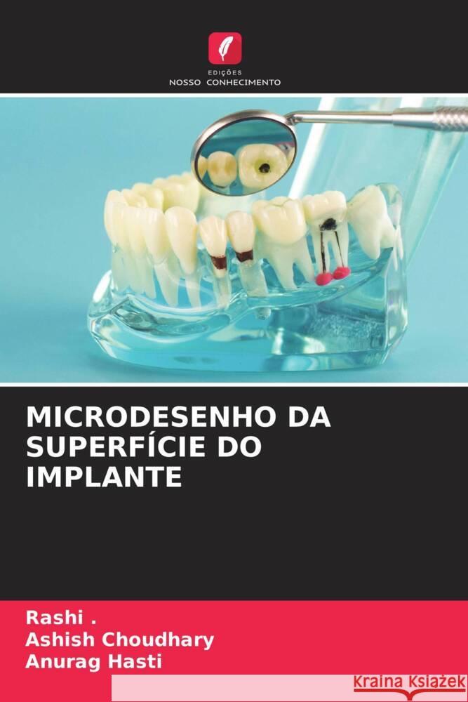 MICRODESENHO DA SUPERFÍCIE DO IMPLANTE ., Rashi, Choudhary, Ashish, Hasti, Anurag 9786205151181 Edições Nosso Conhecimento