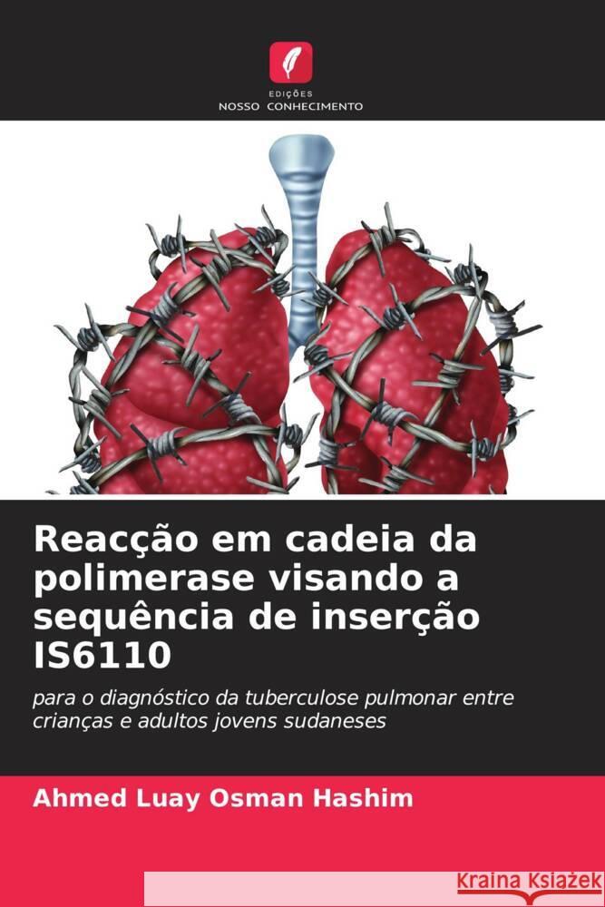 Reacção em cadeia da polimerase visando a sequência de inserção IS6110 Hashim, Ahmed Luay Osman 9786205154038