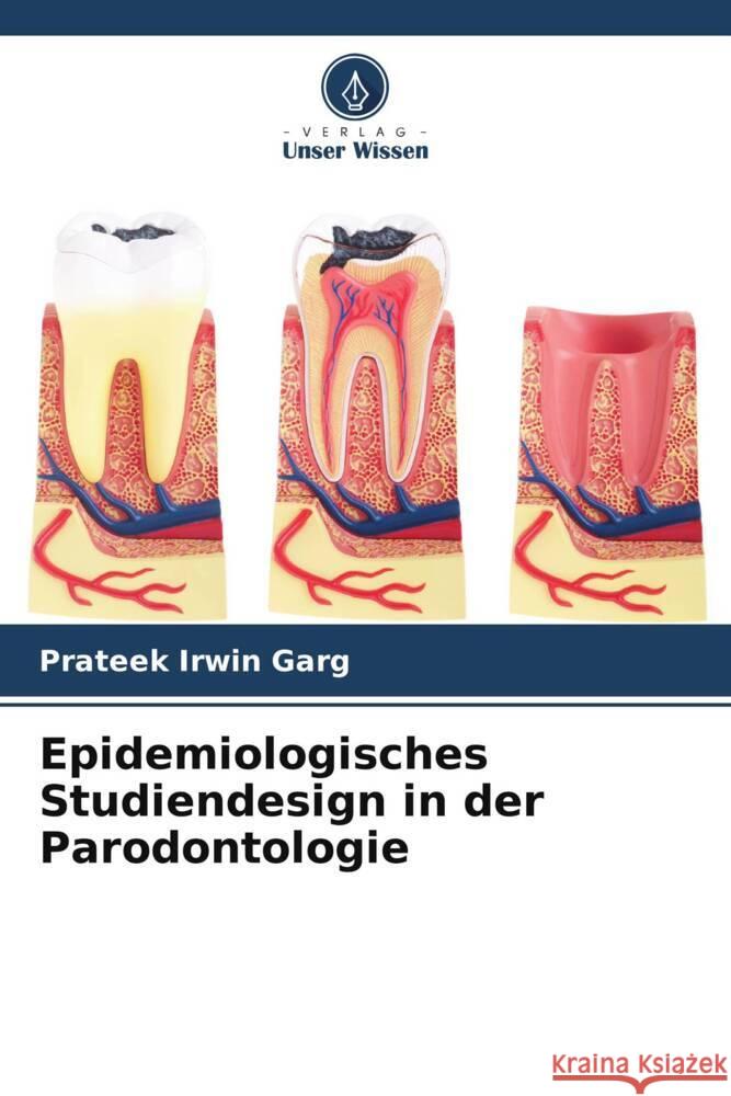 Epidemiologisches Studiendesign in der Parodontologie Garg, Prateek Irwin 9786205154410