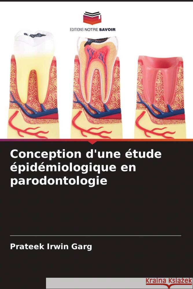 Conception d'une étude épidémiologique en parodontologie Garg, Prateek Irwin 9786205154427