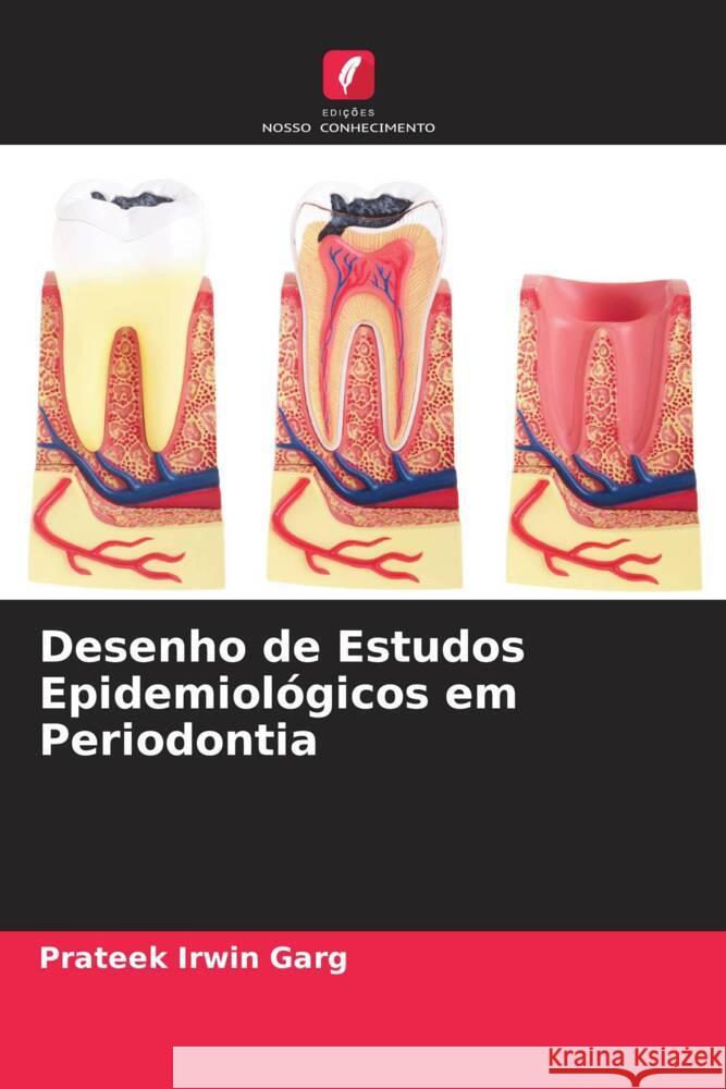 Desenho de Estudos Epidemiológicos em Periodontia Garg, Prateek Irwin 9786205154458