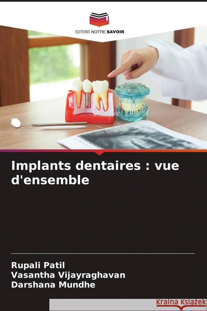 Implants dentaires : vue d'ensemble Patil, Rupali, Vijayraghavan, Vasantha, Mundhe, Darshana 9786205161531