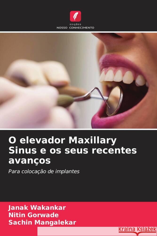 O elevador Maxillary Sinus e os seus recentes avanços Wakankar, Janak, Gorwade, Nitin, Mangalekar, Sachin 9786205162668 Edições Nosso Conhecimento