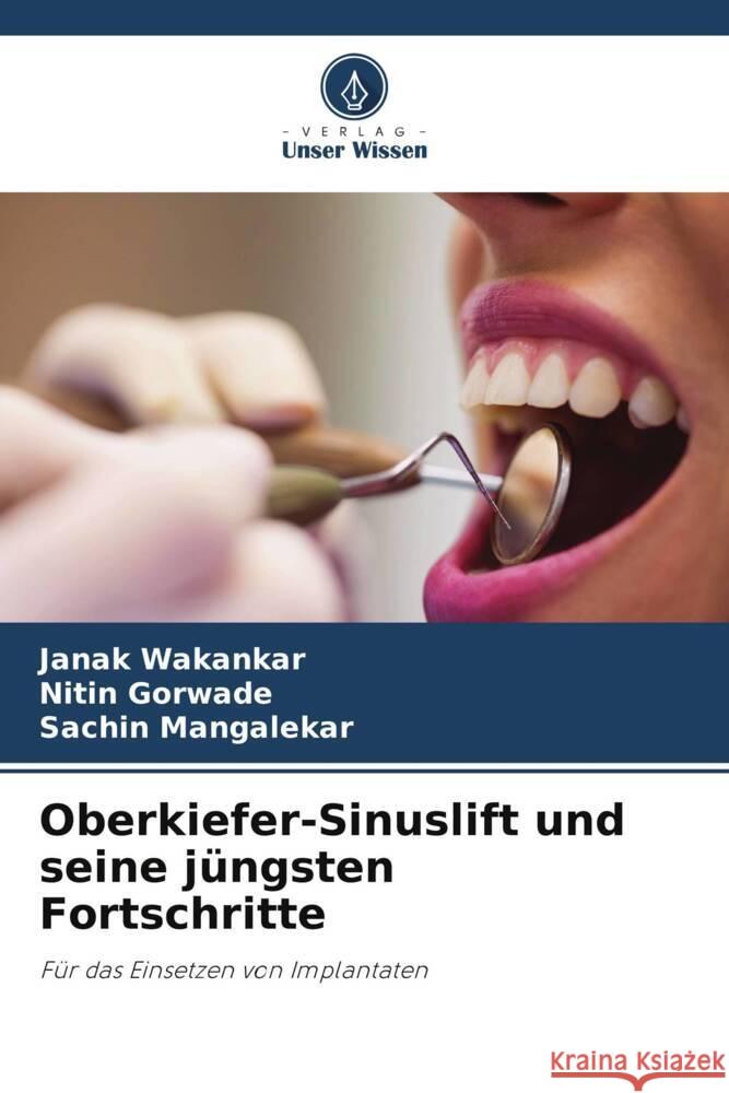 Oberkiefer-Sinuslift und seine jüngsten Fortschritte Wakankar, Janak, Gorwade, Nitin, Mangalekar, Sachin 9786205162675 Verlag Unser Wissen