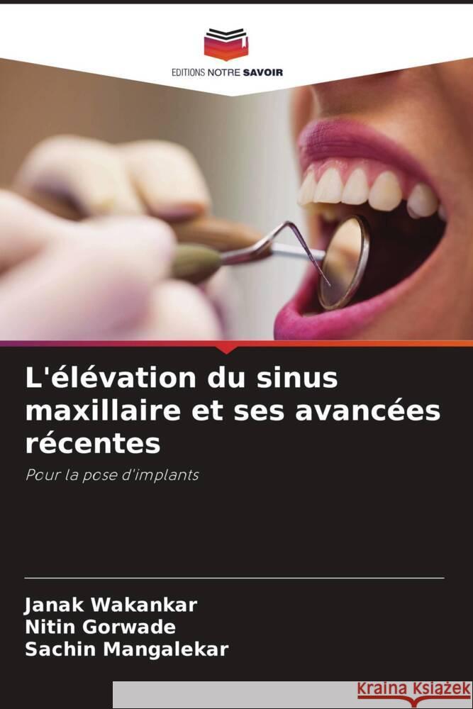 L'élévation du sinus maxillaire et ses avancées récentes Wakankar, Janak, Gorwade, Nitin, Mangalekar, Sachin 9786205162699 Editions Notre Savoir