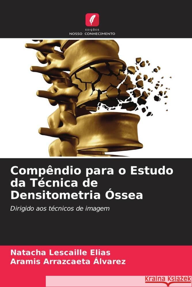 Compêndio para o Estudo da Técnica de Densitometria Óssea Lescaille Elias, Natacha, Arrazcaeta Álvarez, Aramis 9786205162910 Edições Nosso Conhecimento