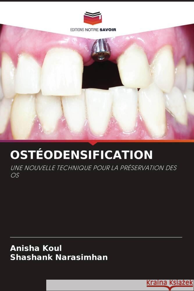 OSTÉODENSIFICATION Koul, Anisha, Narasimhan, Shashank 9786205163146 Editions Notre Savoir