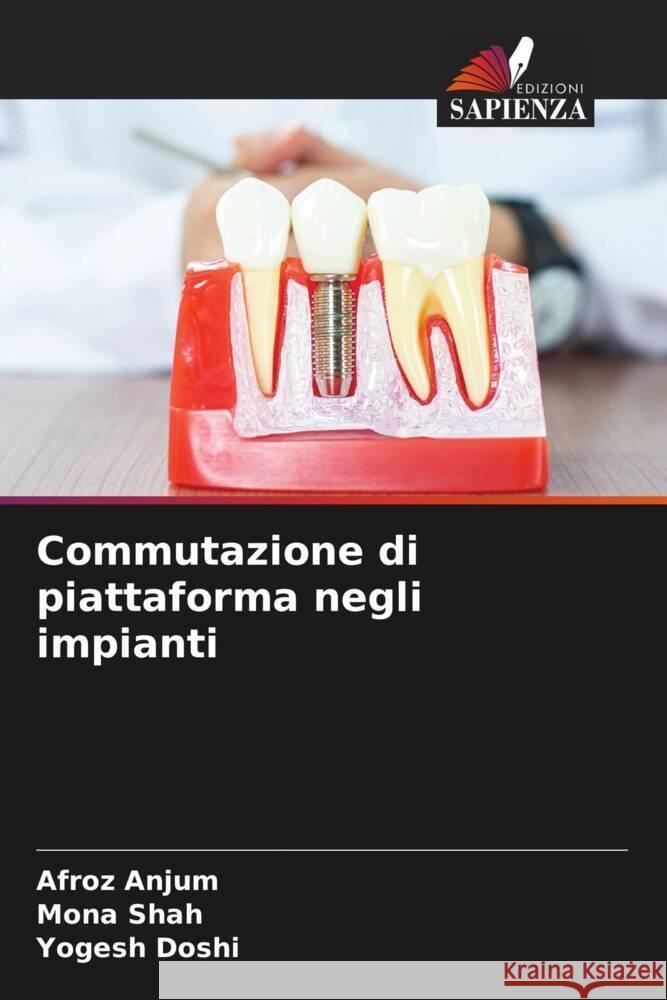 Commutazione di piattaforma negli impianti Anjum, Afroz, Shah, Mona, Doshi, Yogesh 9786205164136 Edizioni Sapienza