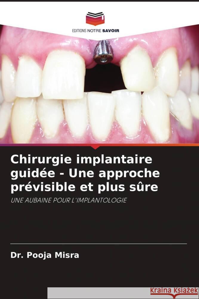 Chirurgie implantaire guidée - Une approche prévisible et plus sûre Misra, Dr. Pooja 9786205164778