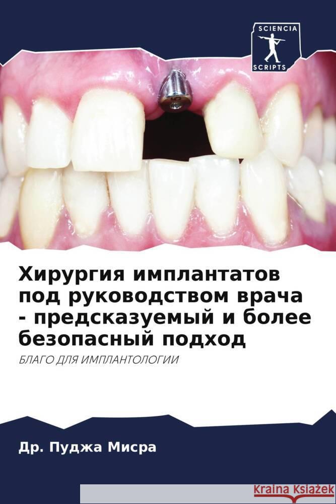 Hirurgiq implantatow pod rukowodstwom wracha - predskazuemyj i bolee bezopasnyj podhod Misra, Dr. Pudzha 9786205164808